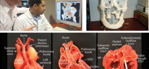 3D Printing is Giving Healthcare a Whole New Dimension
