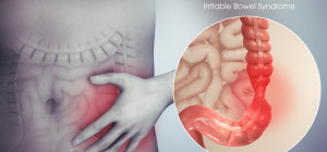 Herbal and Natural Remedies for IBS (Irritable Bowel Syndrome)