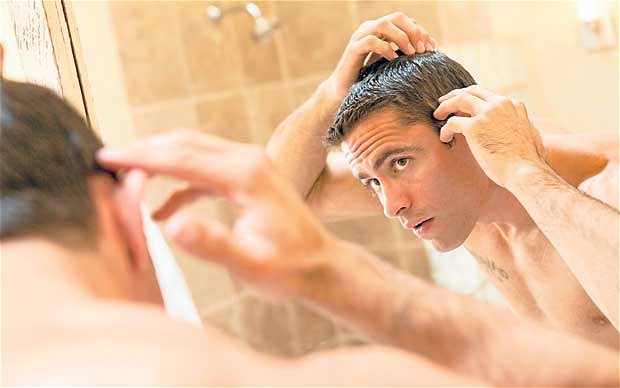Costs Involved In Solving Baldness Complications