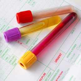 What You Need To Know About STDs And STD Tests