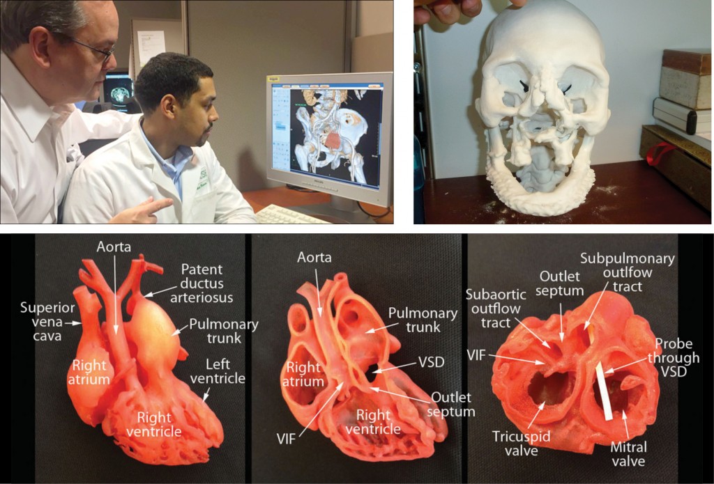 3D Printing is Giving Healthcare a Whole New Dimension