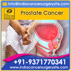 Prostate Cancer-Disorder Summary