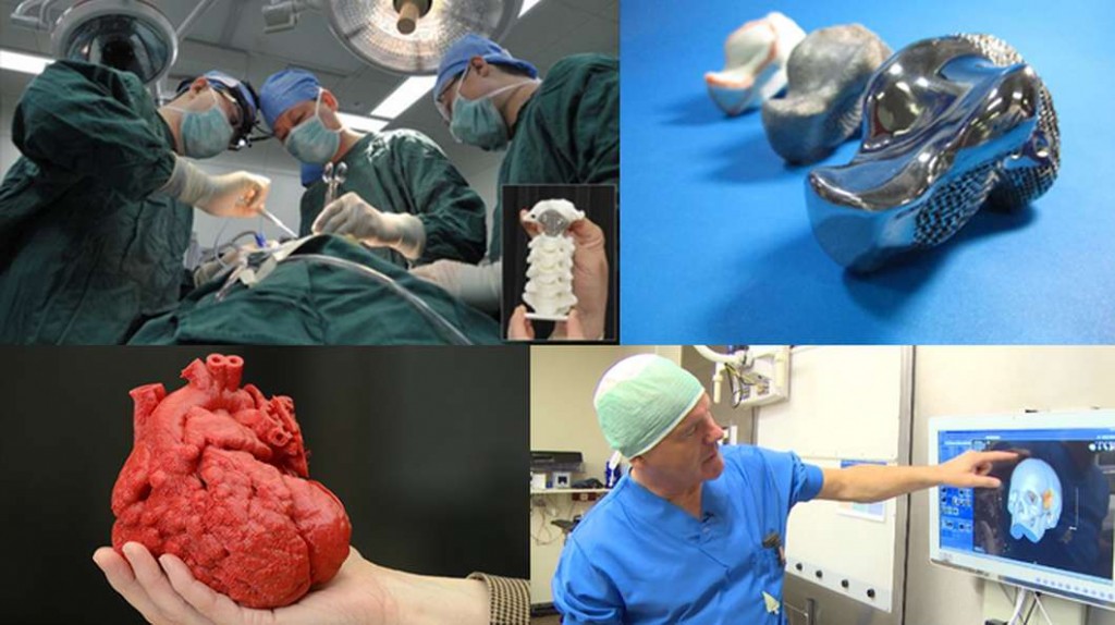 3D Printing Makes Life Changing Surgeries Possible