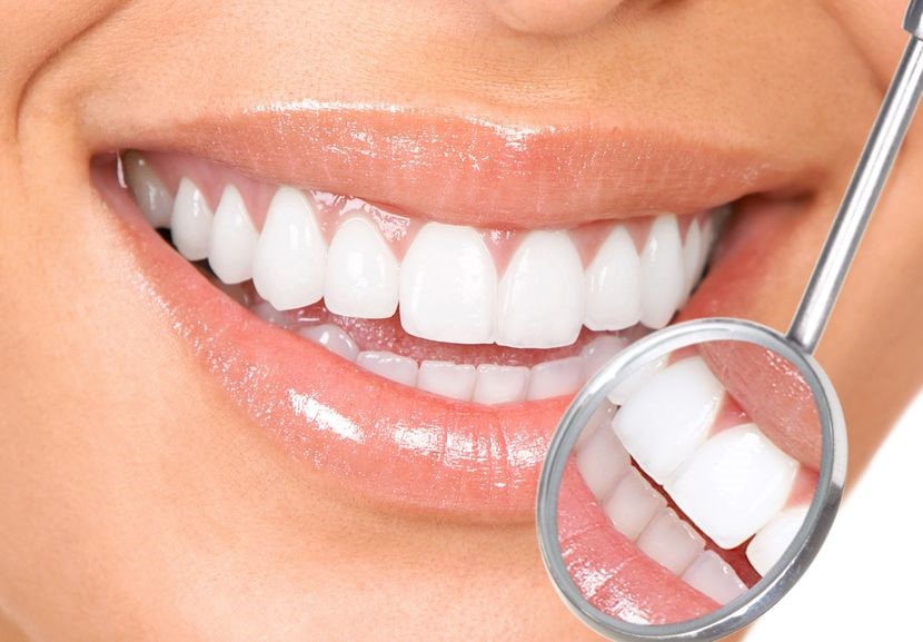 5 Natural Ways to Whiten Yellow or Discolored Teeth