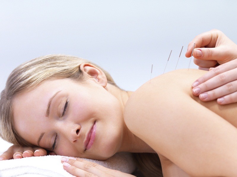 When You Should Visit an Acupuncturist over a Chiropractor or Physiotherapist
