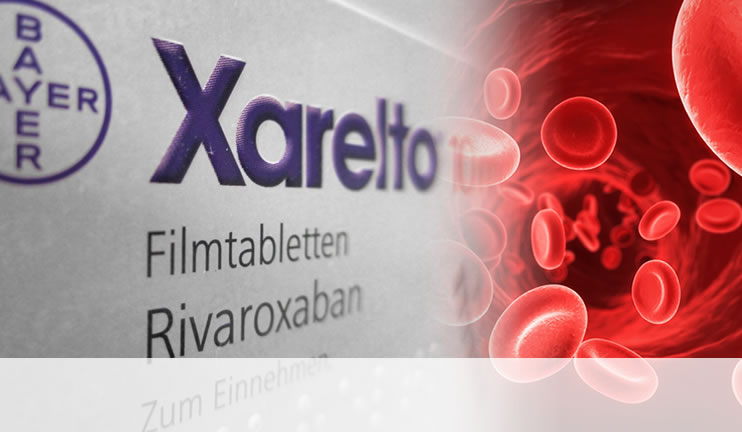 A Major Litigation Process Prompted by a Faulty Drug – Xarelto