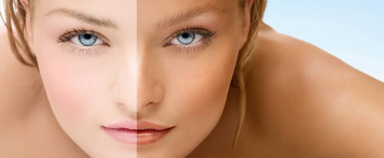 How To Remove Sun Tan With Natural Face Packs