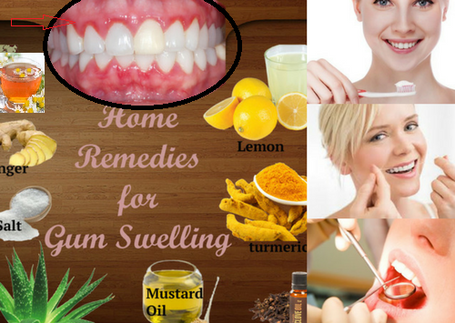 Causes And Treatments For Gums Inflammation