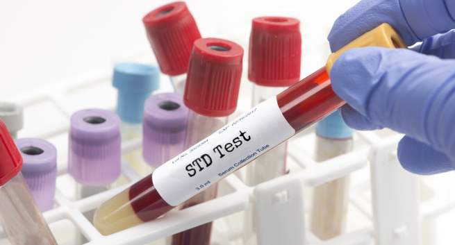 Why You Absolutely Need to Test For STDs and Infection