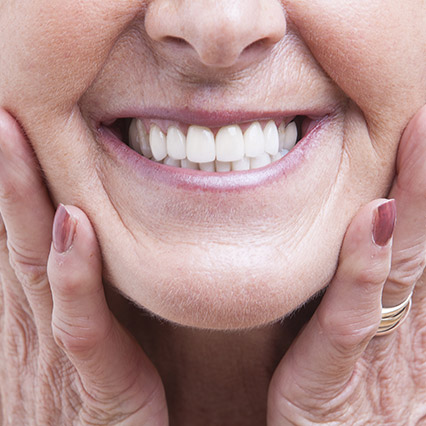 Benefits of All-on-4 Dental Implants