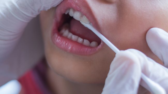 Could Fluoride Varnish Prevent Cavities in Milk Teeth?