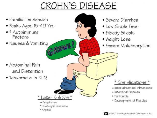 Why Do Western Countries Have High Rates Of Crohn’s?