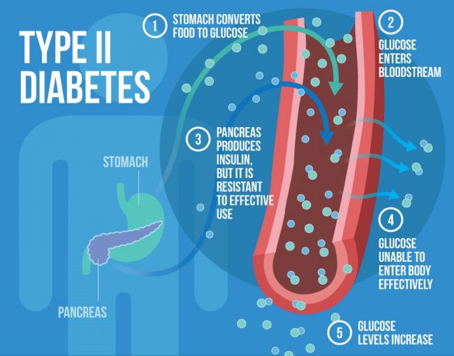 Eight Guidelines for Developing Type II Diabetes