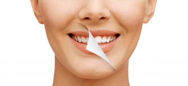 Why It Pays to Plan Ahead for a Smile Makeover