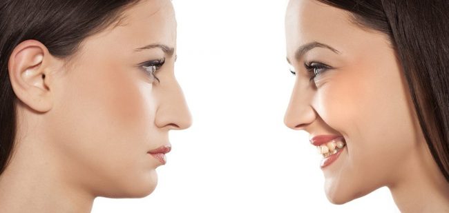 The Psychology of Cosmetic Surgery in Perth