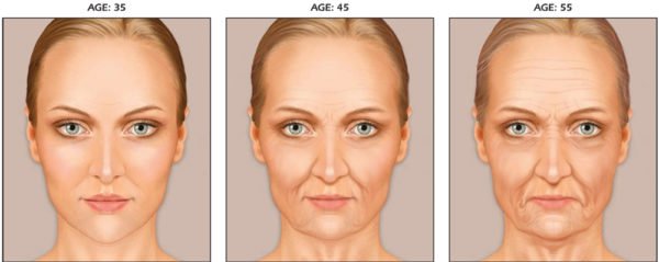 The Skin and the Aging Process