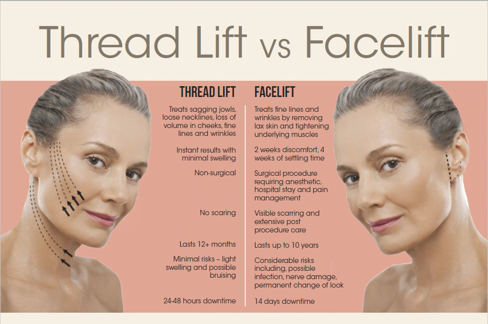 Facelift or Thread Lift?