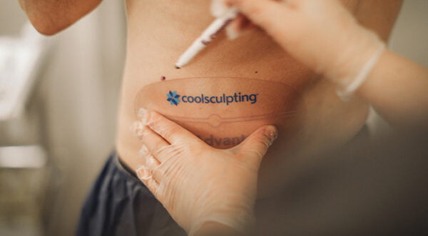 The Secret Behind the Revolutionary Coolsculpting Treatment