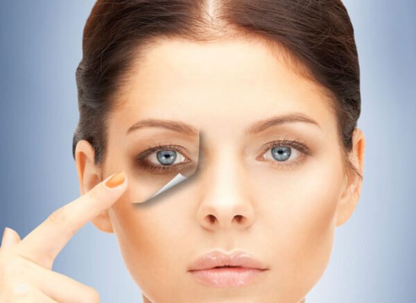 Why Do We Get Dark Circles under our Eyes?