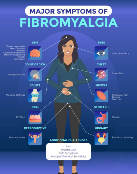  Navigating Relief: A Comprehensive Guide to Medications for Fibromyalgia